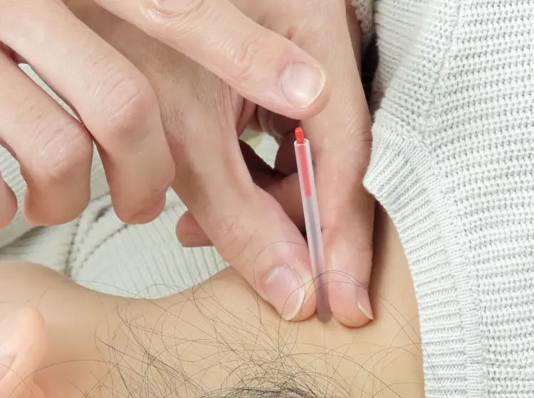 当院で使用する鍼