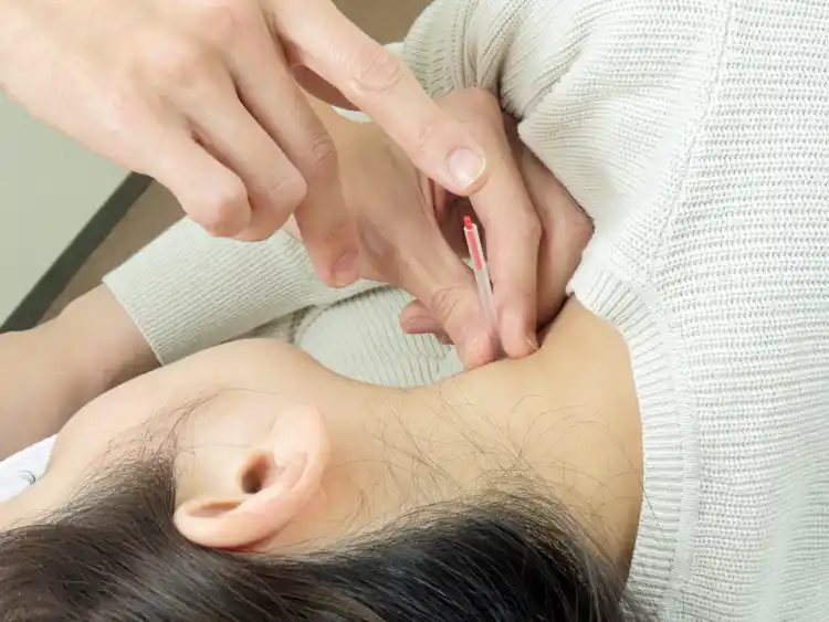 STEP05　鍼の施術