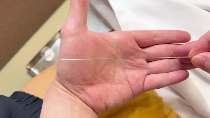 この長さの鍼を、使います